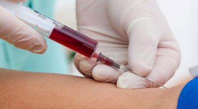 Junín: Vuelven a estar activos los servicios de extracción de sangre, los test de VIH y sífilis