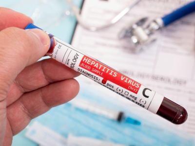 Berisso: Realizarán una campaña gratuita para la detección de Hepatitis