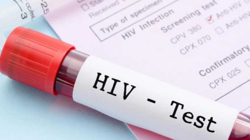 9 de Julio: Se realizan testeos rápidos de VIH gratuitos